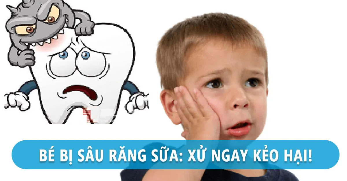 Bé bị sâu răng sữa: Có cách nào khắc phục và ngăn ngừa?