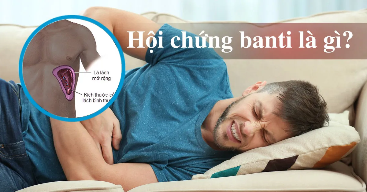 Hội chứng banti là gì?