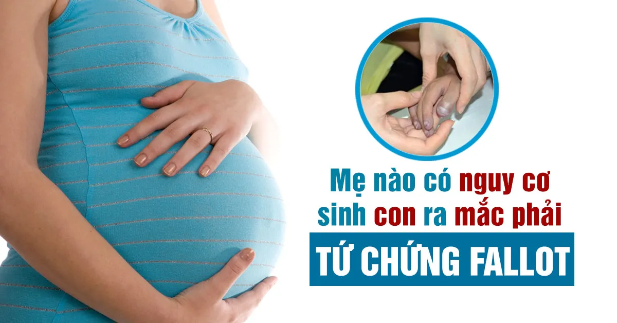 Tứ chứng fallot: Bệnh tim thường gặp ở trẻ em