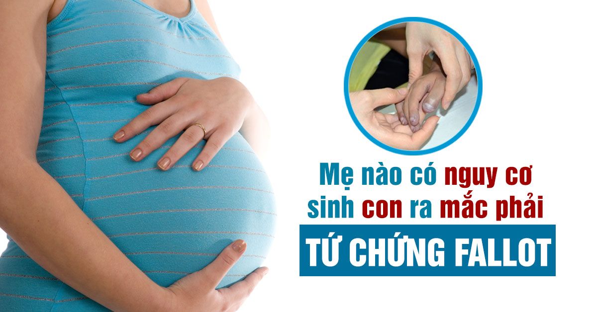 Tứ chứng fallot: Bệnh tim thường gặp ở trẻ em