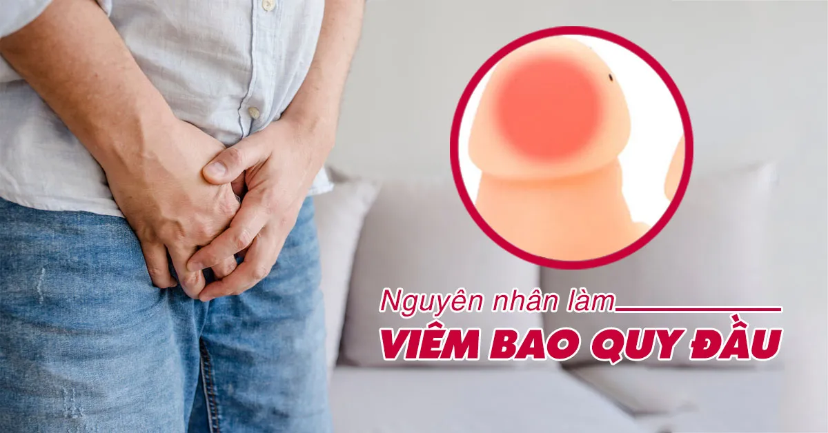 Viêm bao quy đầu – Dấu hiệu nhận biết và cách chữa trị