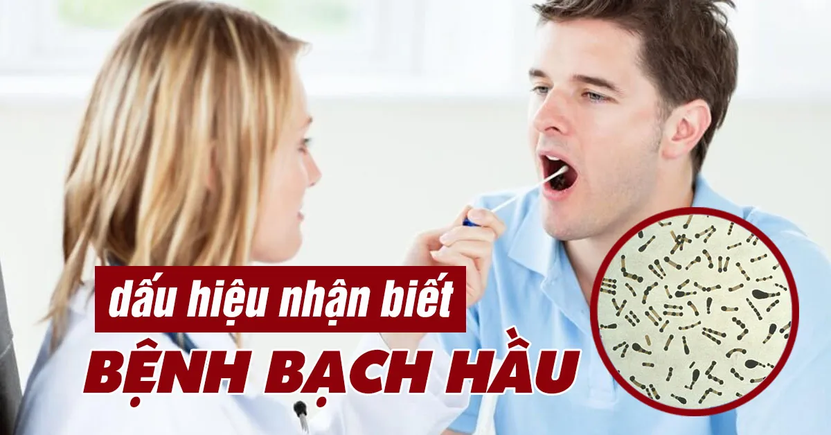 Bệnh bạch hầu - dấu hiệu nhận biết và biện pháp phòng tránh