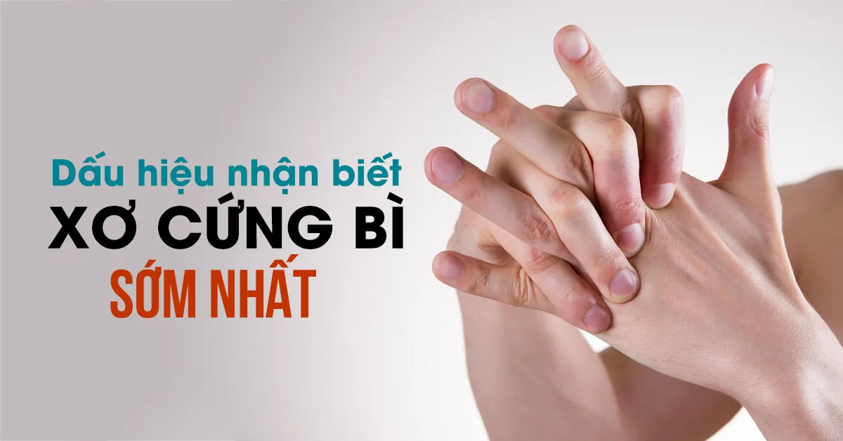 Xơ cứng bì: Tìm hiểu các triệu chứng và cách điều trị