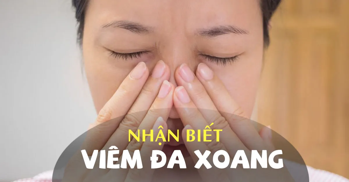Viêm đa xoang: Nguyên nhân, triệu chứng và cách chữa bệnh hiệu quả