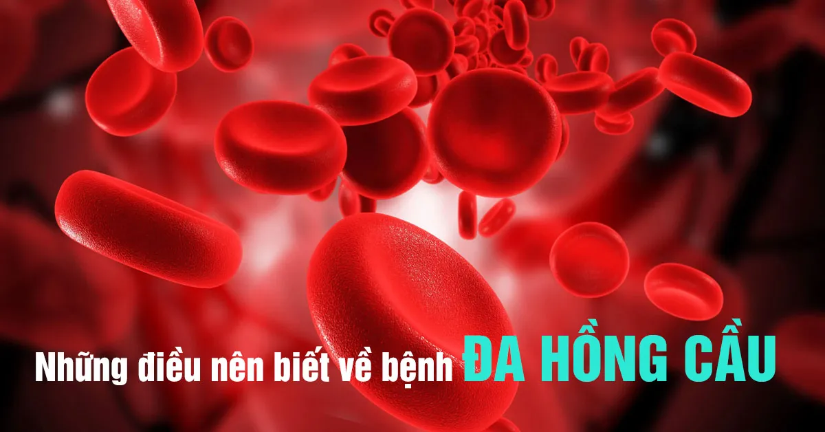 Bệnh đa hồng cầu và những điều ai cũng cần biết