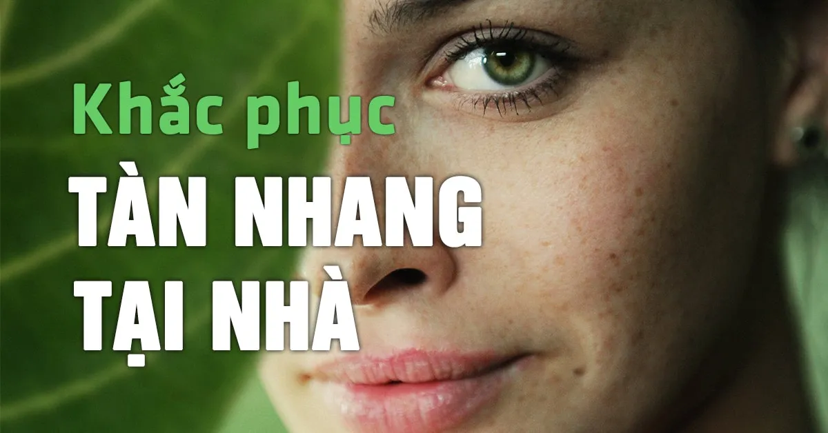 9 cách trị tàn nhang tại nhà bằng nguyên liệu thiên nhiên