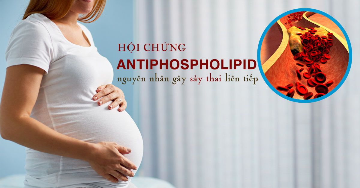 Hội chứng antiphospholipid là gì? Có nguy hiểm không?