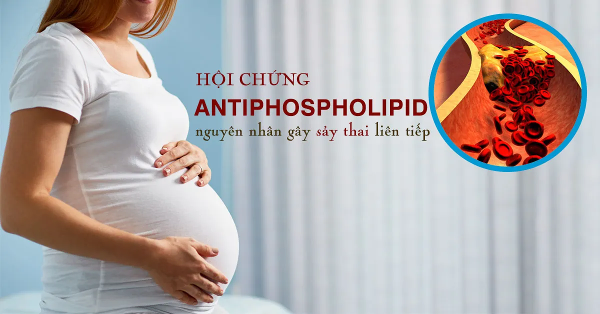 Hội chứng antiphospholipid là gì? Có nguy hiểm không?