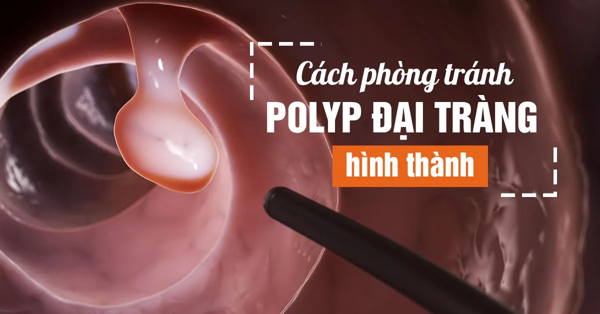 Polyp đại tràng có nguy hiểm không?