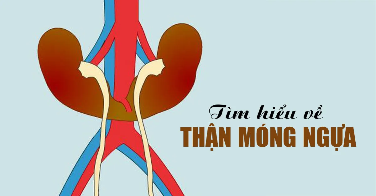 Thận móng ngựa là gì, nguy hiểm ra sao?