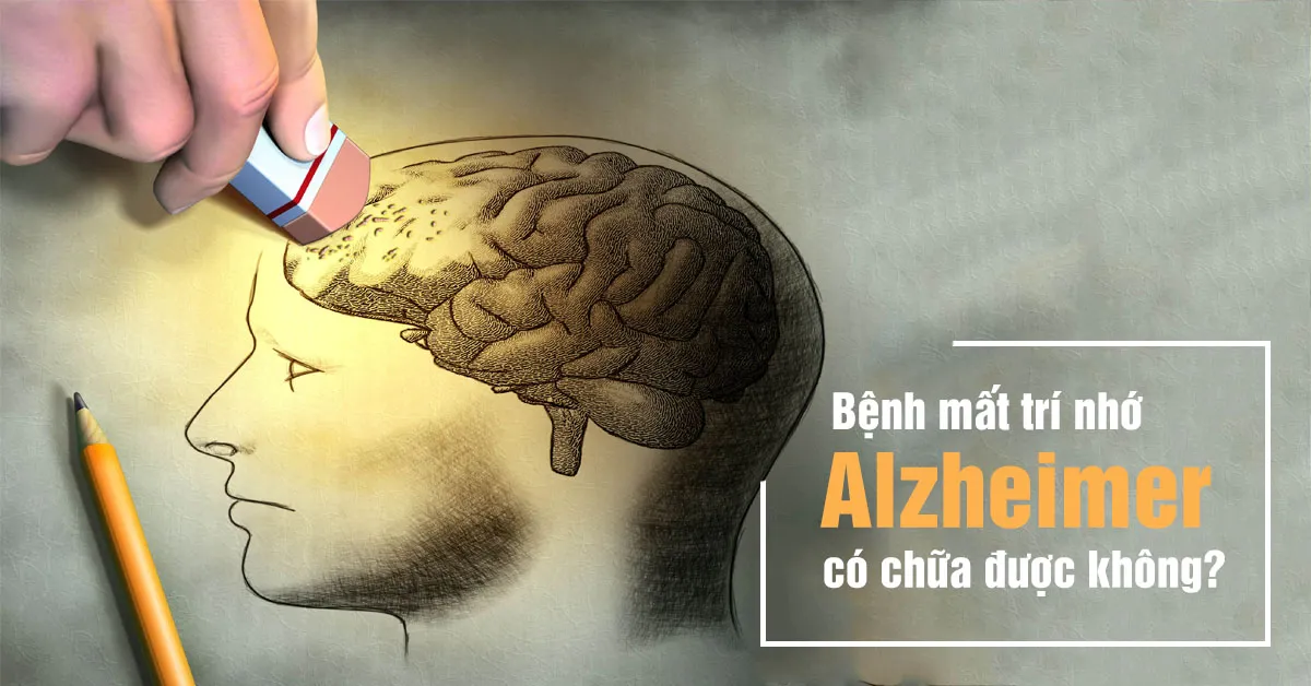 Bệnh Alzheimer là gì và các yếu tố làm tăng nguy cơ mắc bệnh mất trí nhớ?