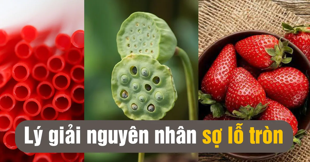 Hội chứng sợ lỗ - nguyên nhân và cách điều trị