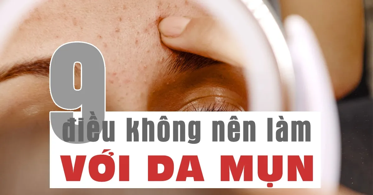 ‘Chỉ điểm’ những thói quen xấu khiến da ‘mụn vẫn hoàn mụn’