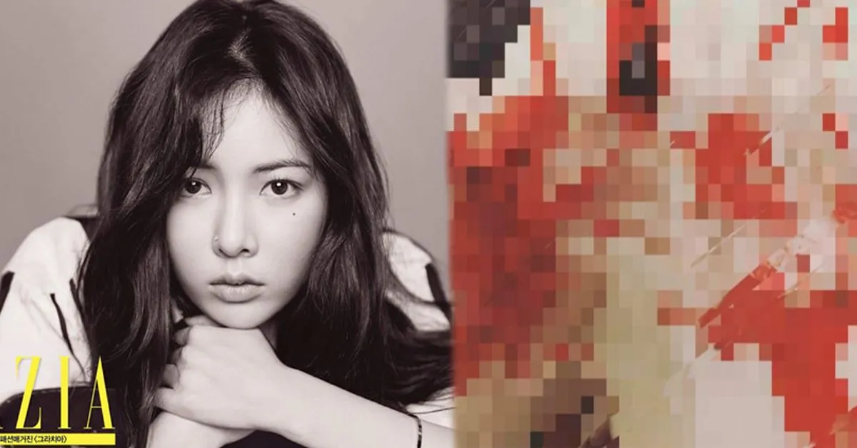Hyuna đăng ảnh đầy máu me khiến người hâm mộ đứng ngồi không yên