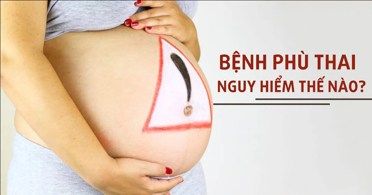 Bệnh phù thai là gì? Làm sao nhận biết và điều trị kịp thời?