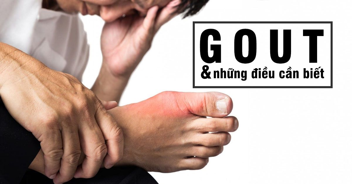 Bệnh gout và những điều cần biết