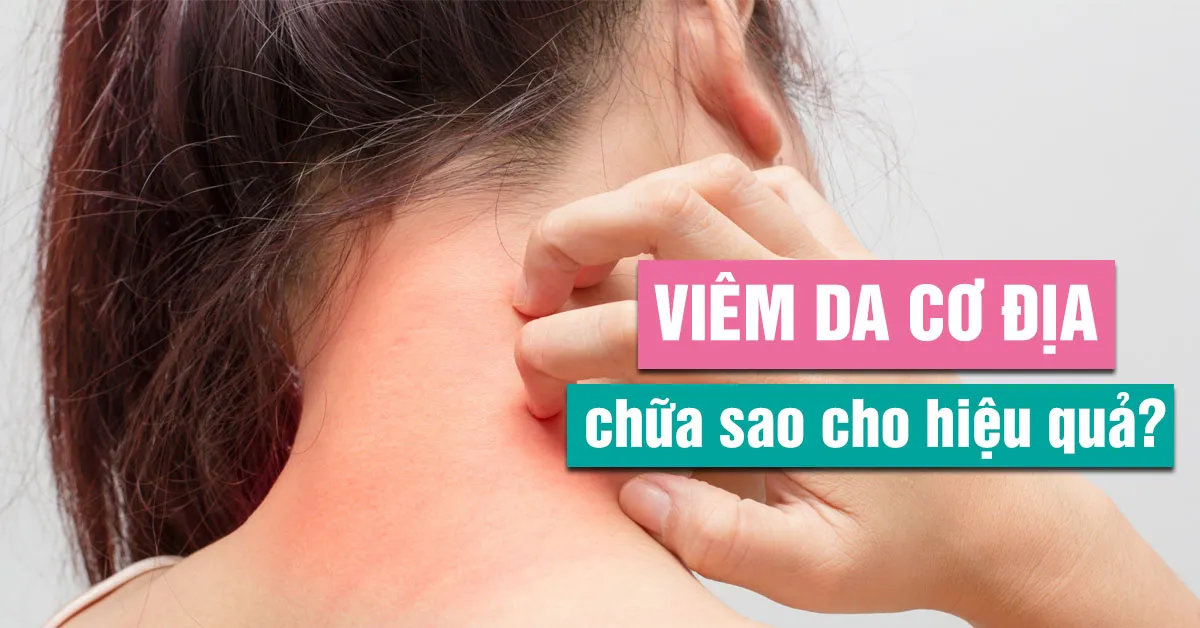 Viêm da cơ địa: Nhận biết, chữa trị và chăm sóc da đúng cách