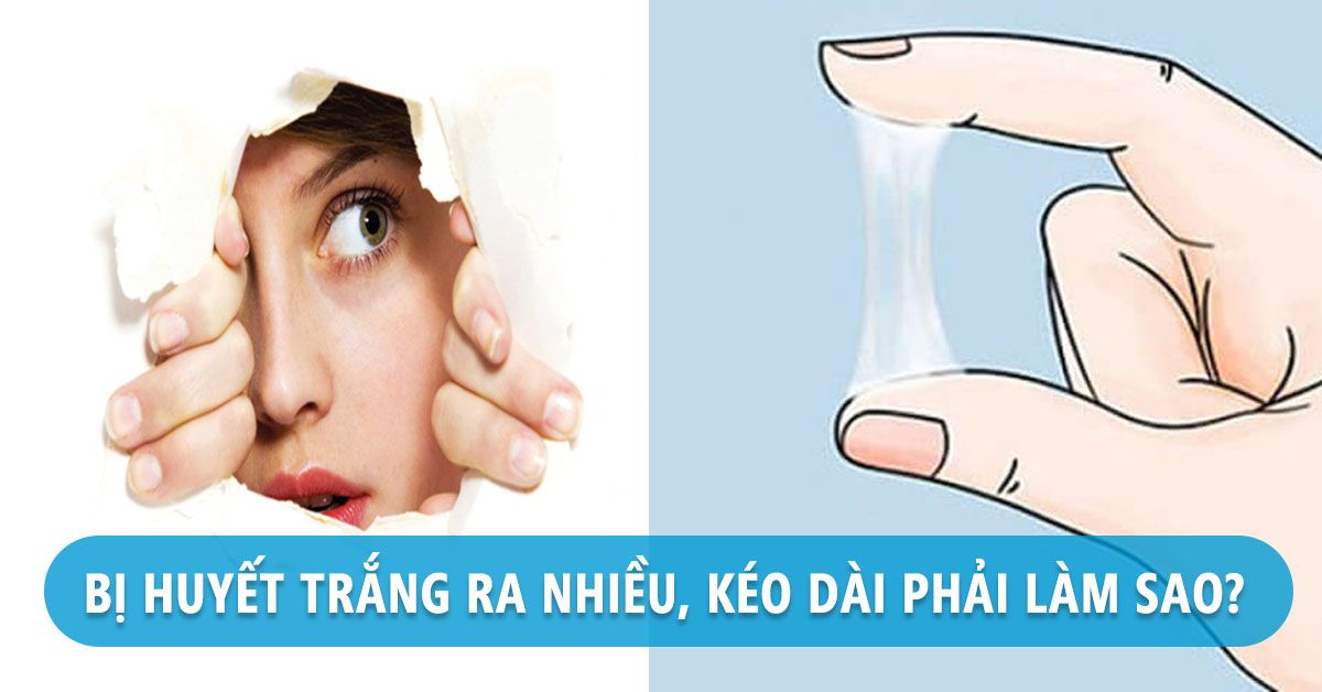 Bị huyết trắng có thể chữa bằng cách nào?