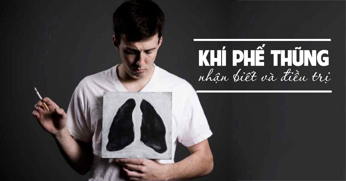 Khí phế thũng là bệnh gì?
