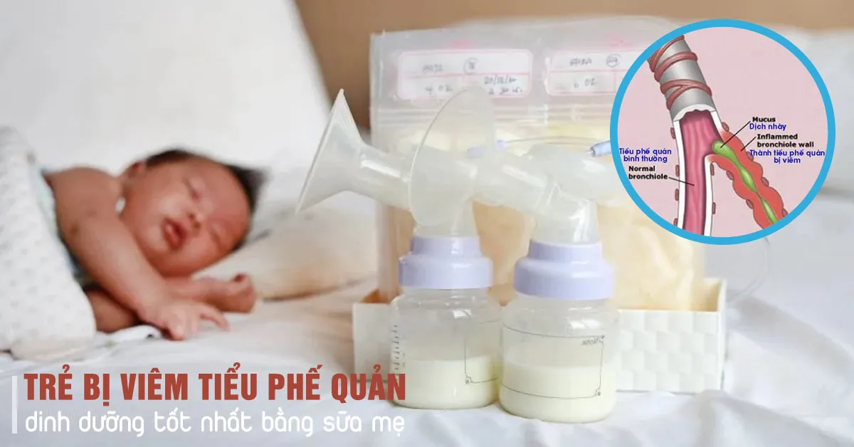 Học cách cho bé bú khi bé bị viêm tiểu phế quản