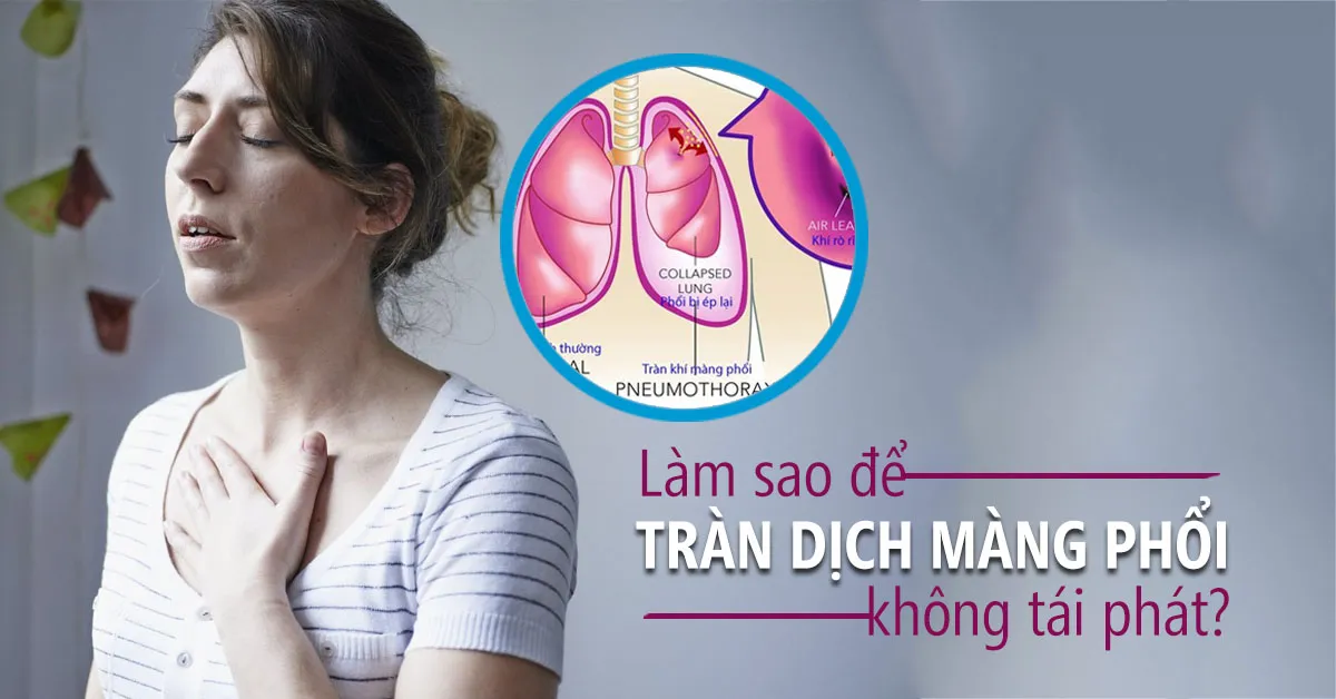 Vì sao tràn dịch màng phổi dễ tái phát?