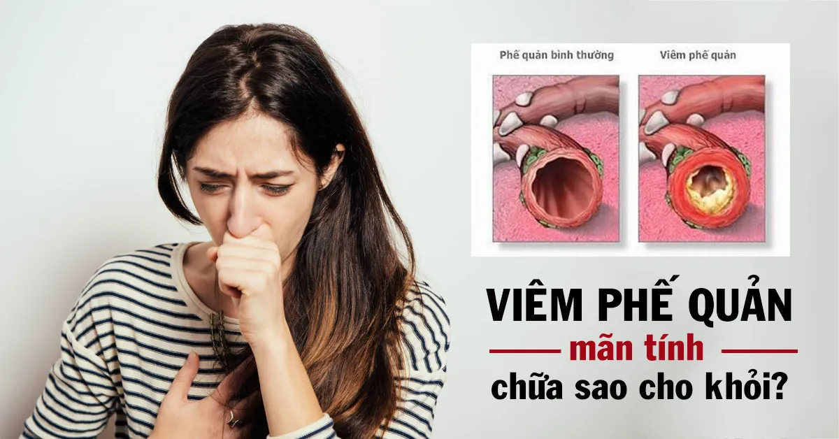 Viêm phế quản mãn tính chữa như thế nào là hiệu quả nhất?