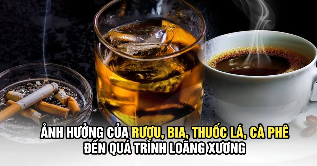 Loãng xương sớm do rượu bia, thuốc lá, cà phê mỗi ngày?