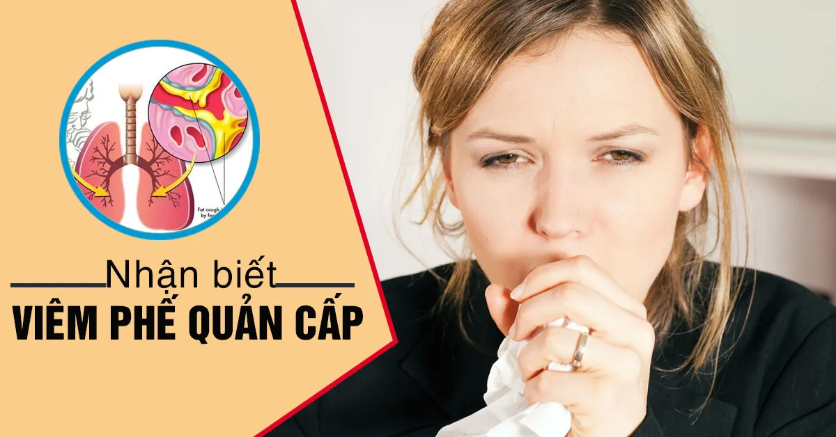 Viêm phế quản cấp và những điều cần biết