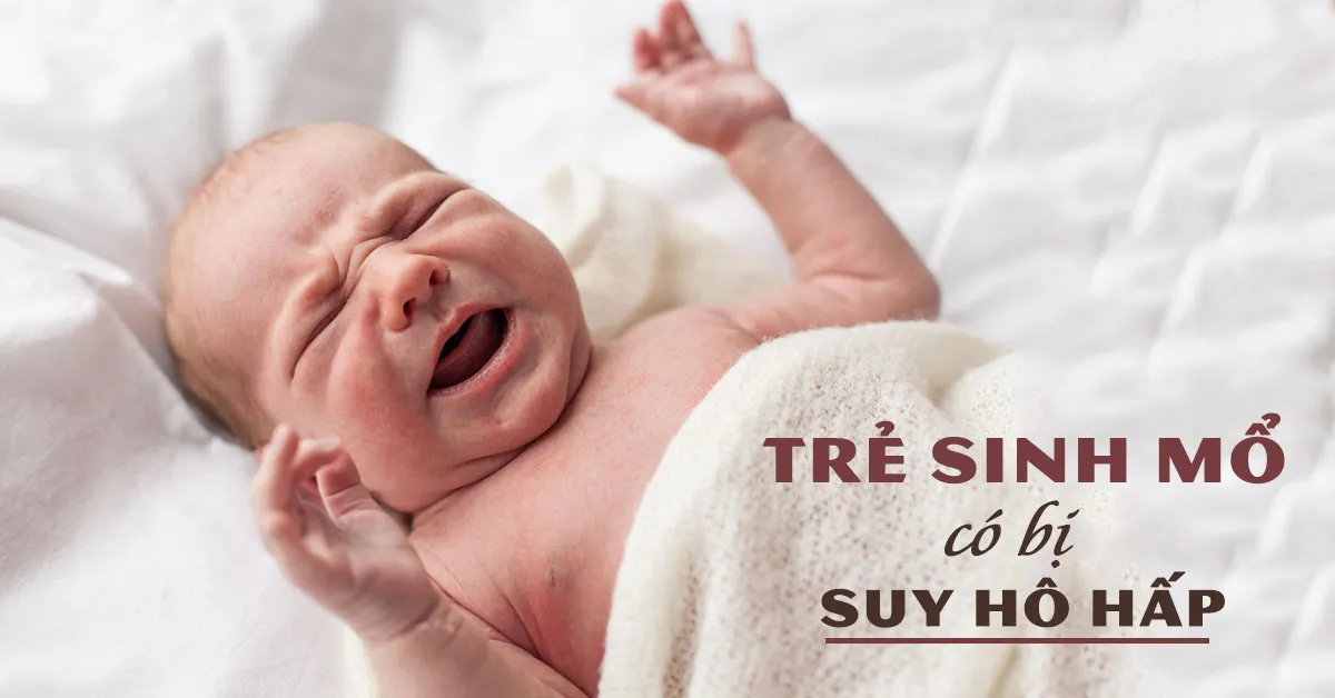 Sinh mổ có dẫn đến tình trạng suy hô hấp ở trẻ sơ sinh?