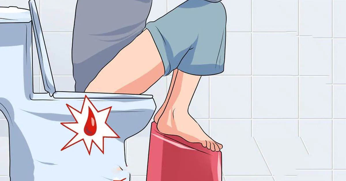 Đi cầu ra máu - tiềm ẩn nhiều căn bệnh nguy hiểm bên trong