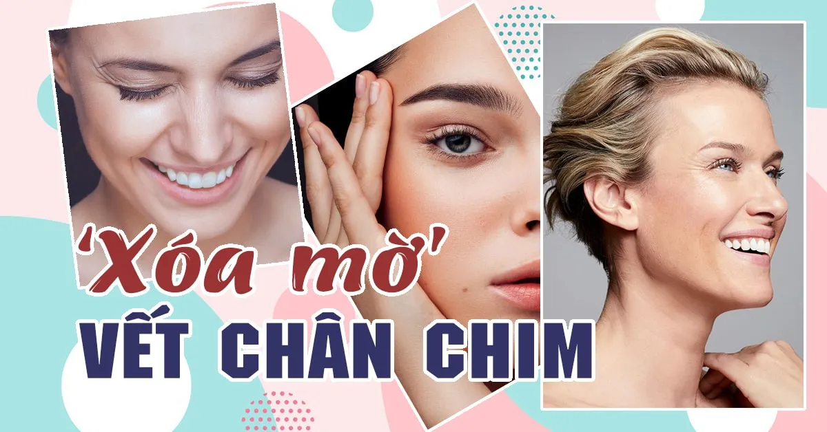 Loại bỏ dấu hiệu tuổi tác với cách ‘xóa’ và ngăn ngừa vết chân chim