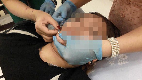 Xử lý nghiêm các cơ sở dịch vụ thẩm mỹ hoạt động không phép