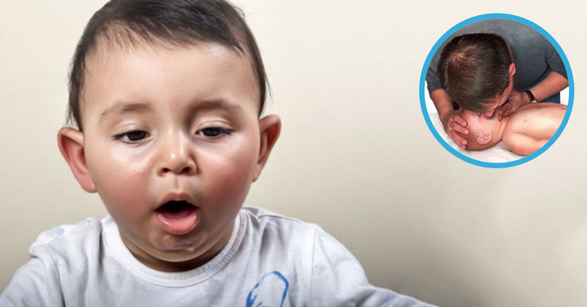 Trẻ hóc dị vật áp dụng phương pháp hà hơi thổi ngạt được không?