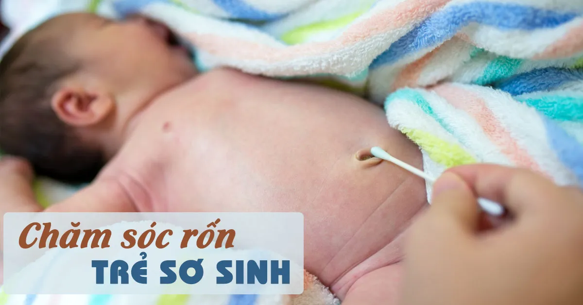 Chăm sóc rốn trẻ sơ sinh như thế nào là đúng cách?