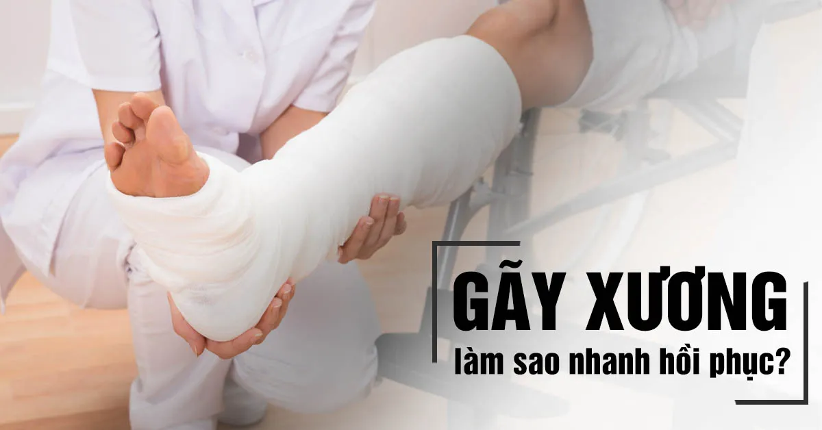 Gãy xương bao lâu thì đi lại được?