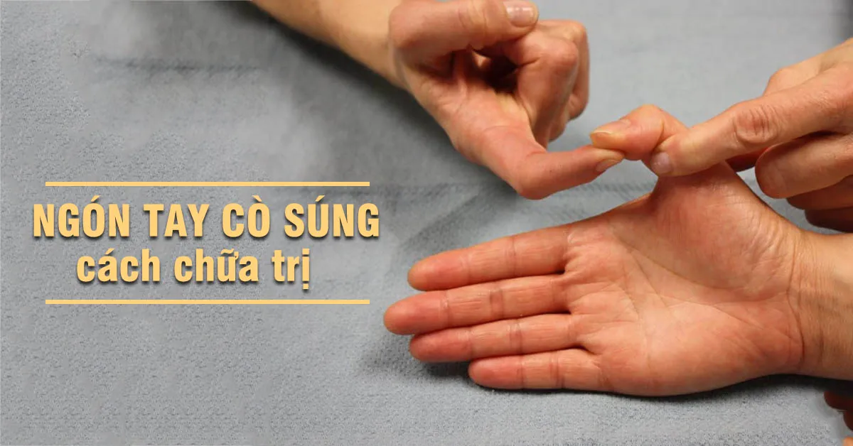 Những cách chữa ngón tay cò súng hiệu quả