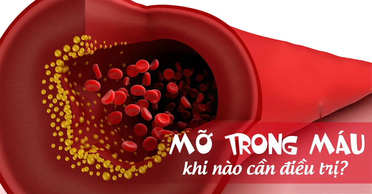 Mỡ trong máu khi nào cần điều trị?