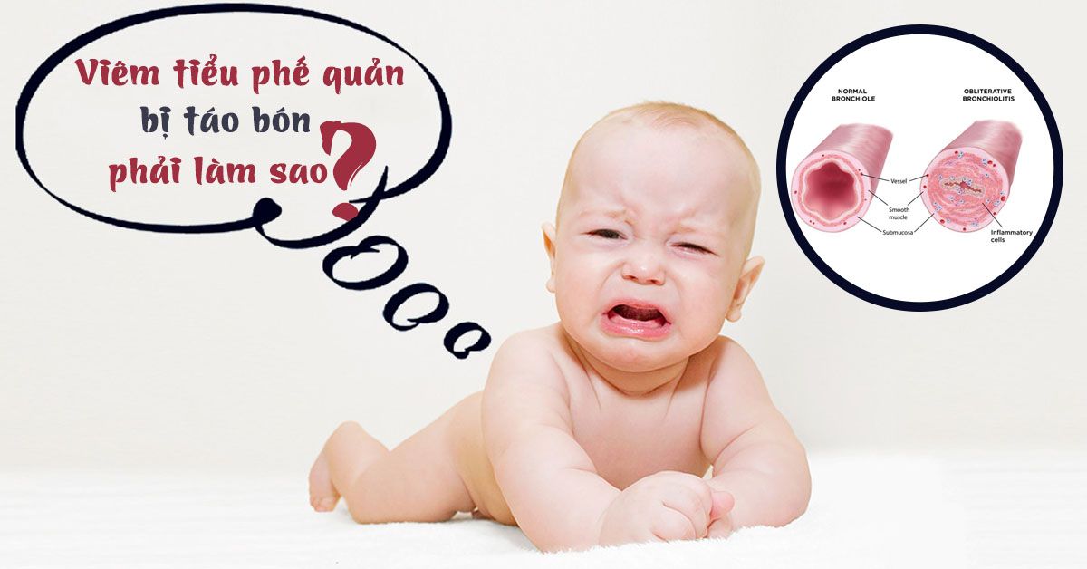 Trẻ bị viêm tiểu phế quản bội nhiễm khó đi ngoài phải làm sao?