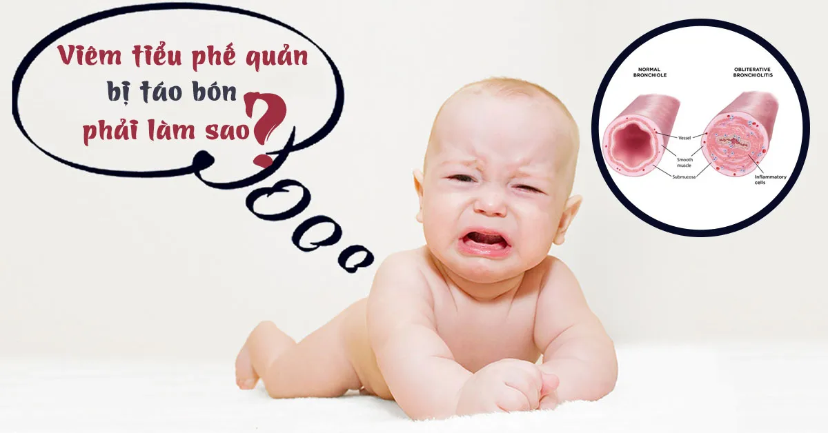 Trẻ bị viêm tiểu phế quản bội nhiễm khó đi ngoài phải làm sao?