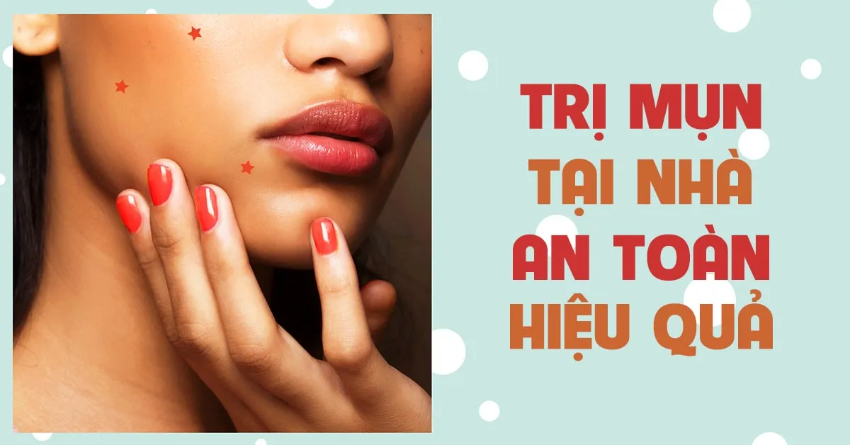 7 biện pháp trị mụn tại nhà nên và không nên áp dụng