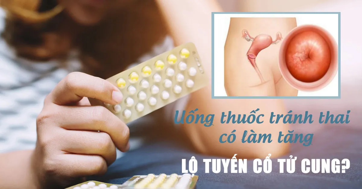 Uống thuốc tránh thai có làm tăng lộ tuyến cổ tử cung?