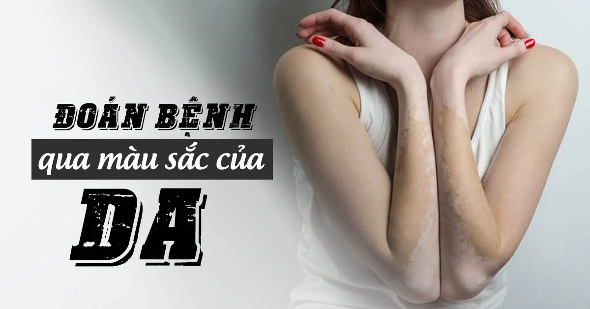 Vùng da bị đổi màu nói lên điều gì về sức khỏe?