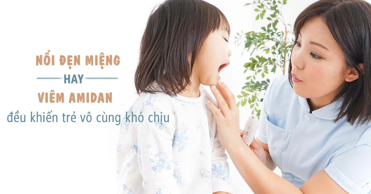 Cách giúp bé giảm đau rát, biếng ăn do bị đẹn miệng, viêm amidan