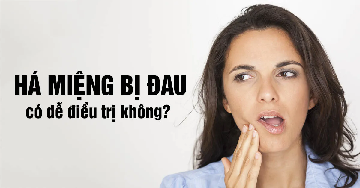 Há miệng bị đau – coi chừng viêm dây thần kinh số 5