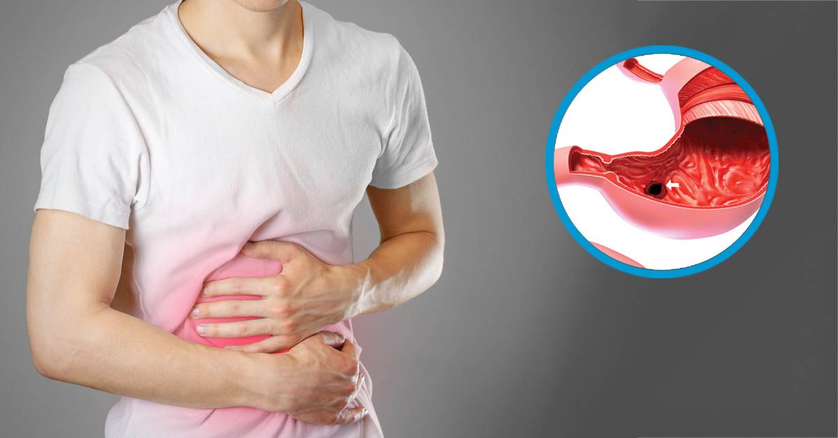 Viêm xung huyết hang vị nên ăn gì?