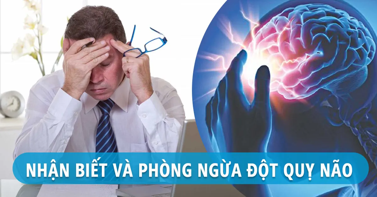 Đột quỵ não: Nguyên nhân, dấu hiệu nhận biết, cách điều trị và phòng ngừa