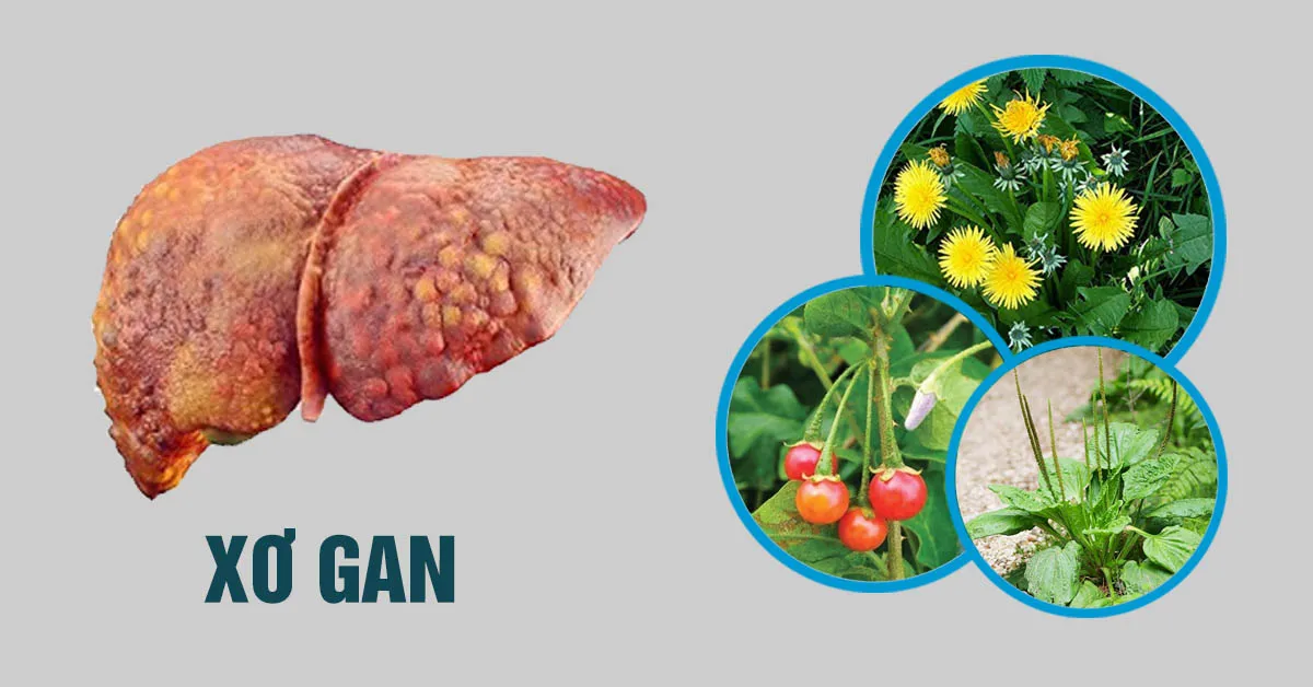 Xơ gan mất bù nên dùng thảo dược gì?