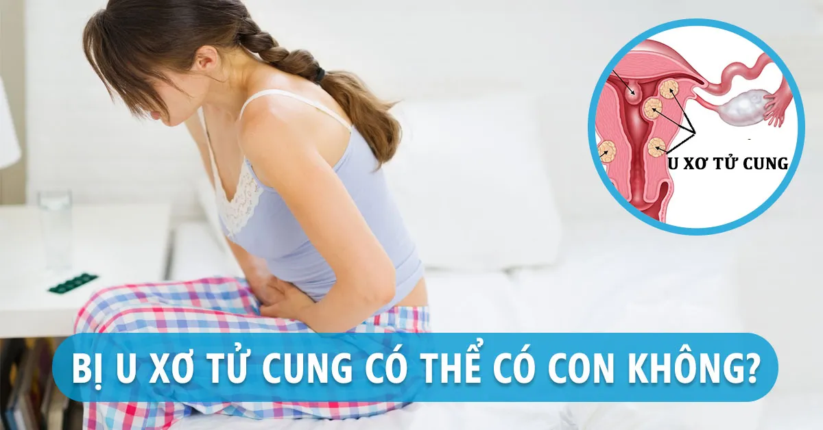 Bị u xơ tử cung có mang thai được không?