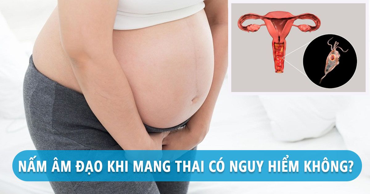 Chớ xem thường nấm âm đạo khi mang thai