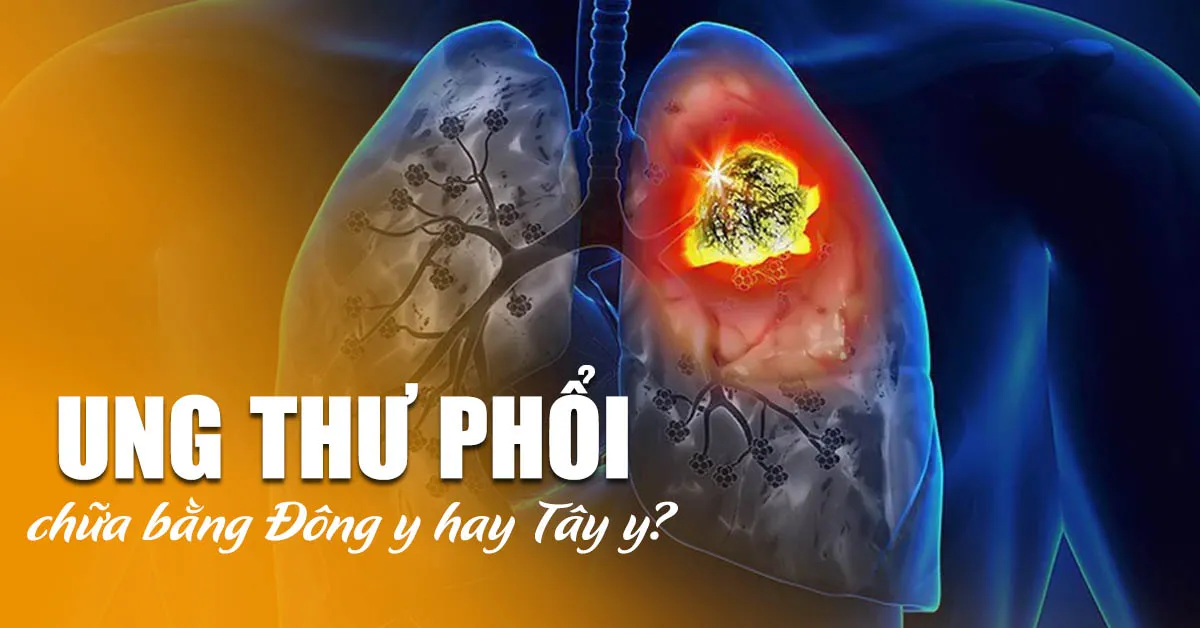 Chữa ung thư phổi bằng thuốc Đông y được không?